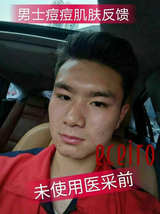 医采护肤品医采护肤品医采护肤品医采护肤品