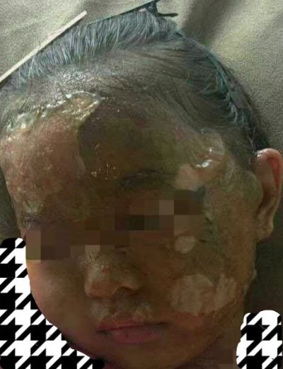 家具配送安装烧伤烫伤未编辑专业未编辑专业