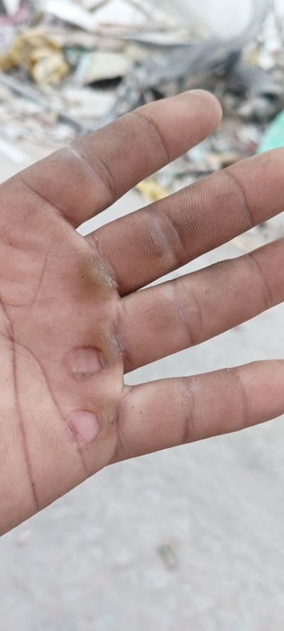 拆除，敲墙，拆除拆除拆迁