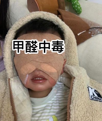 除甲醛未编辑专业未编辑专业未编辑专业