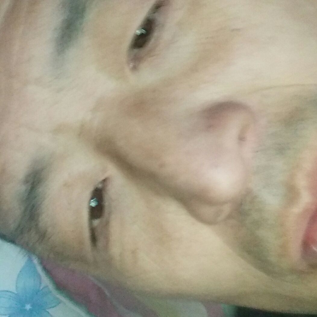 运输