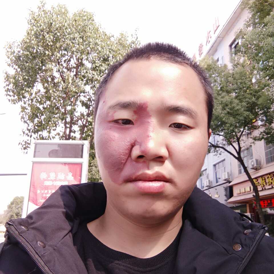 电动工具装配