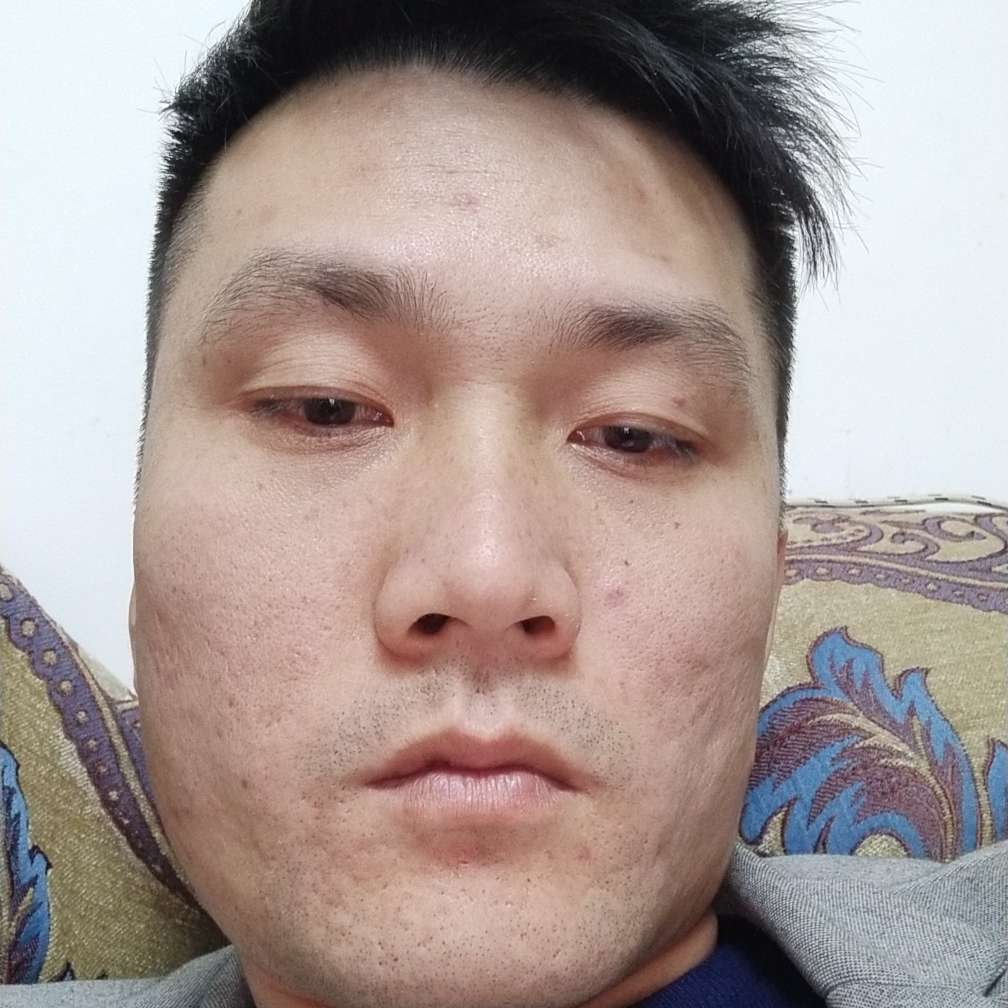 晾衣架净水器