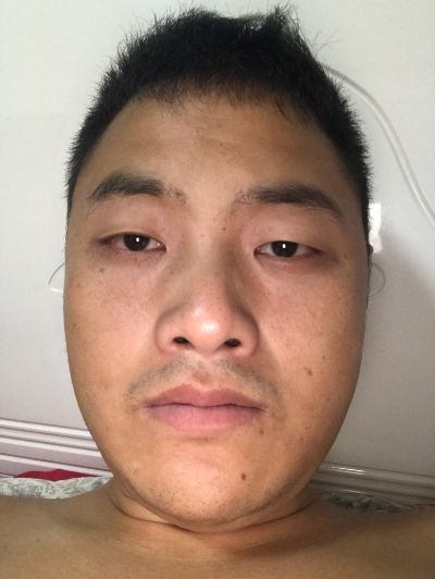 安装