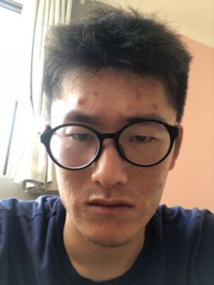 安装