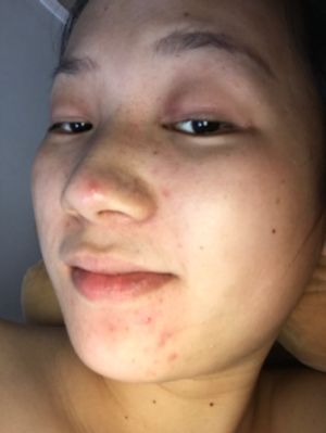 水电