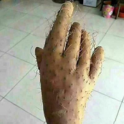 广告