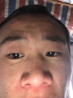 安装维修