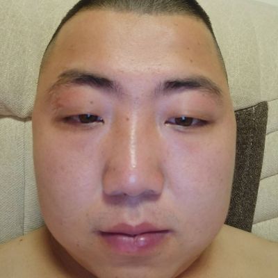 卫浴开孔