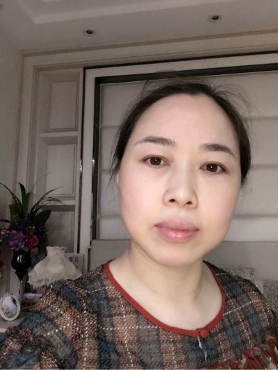不接单