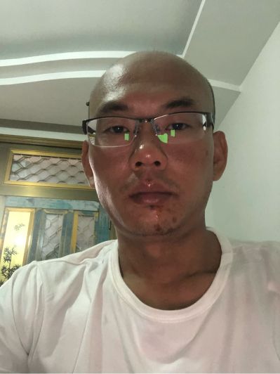 拆除电焊安装