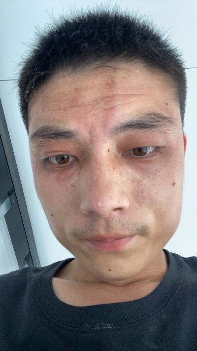 安装