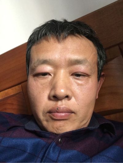 外墙涂料漏水