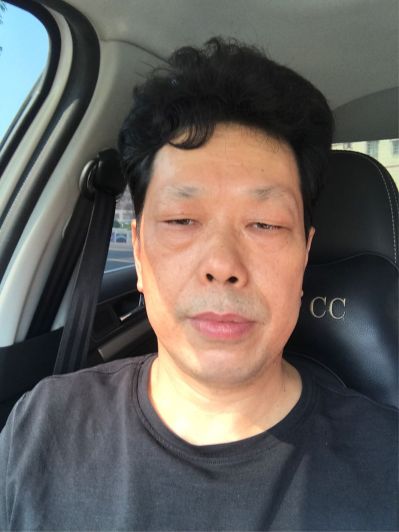 安装