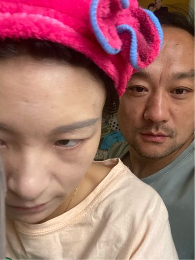 安装