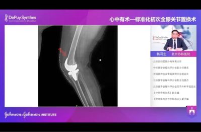 运动康复