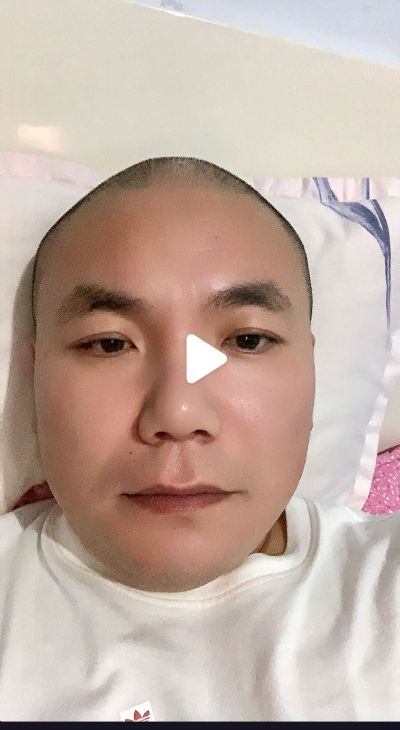 不绣钢扶手无