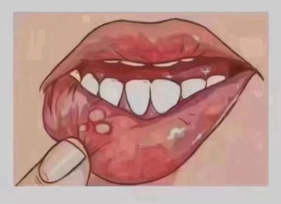 万能修