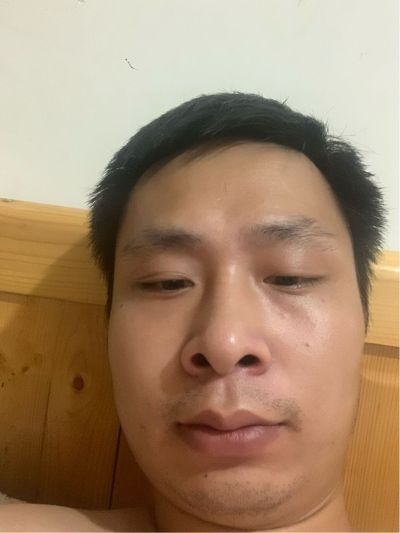 腻子