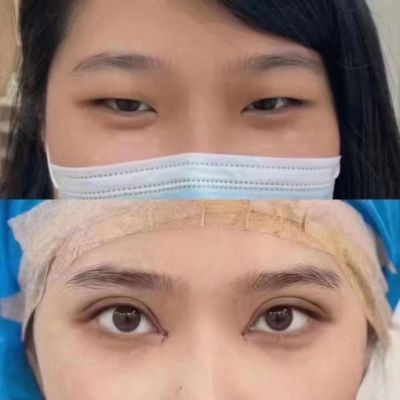 美容