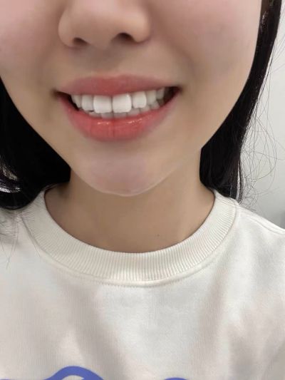 无